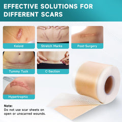 Pumkot scar removal strips on a scar area for gentle, comfortable coverage.
