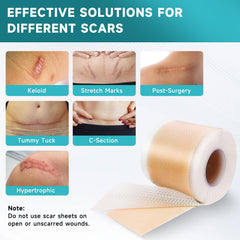 Pumkot silicone scar sheets cut to size for customizable scar coverage