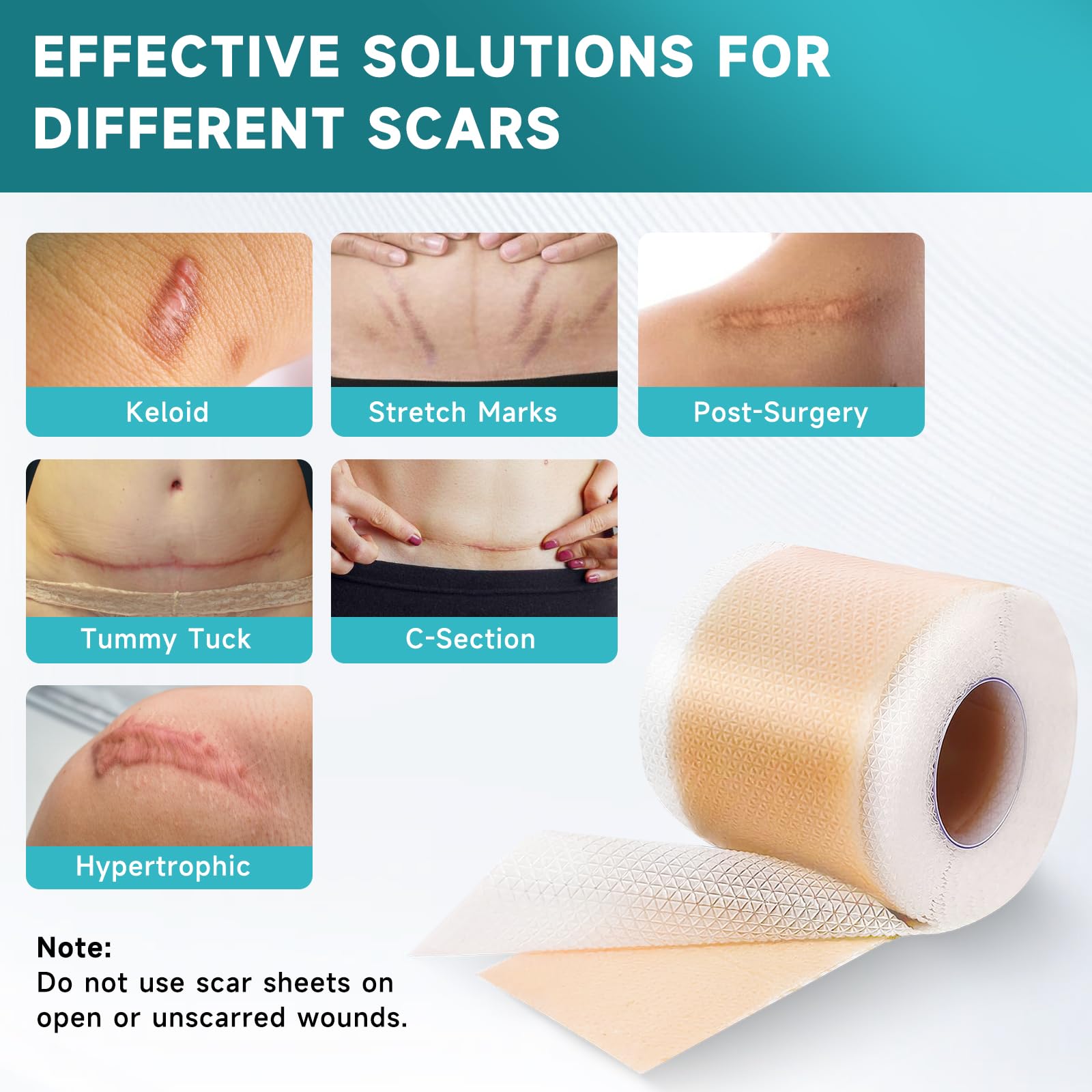 Pumkot silicone scar sheets on skin flattening scar texture