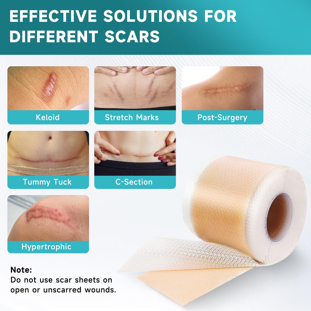 Pumkot silicone scar sheets on skin flattening scar texture