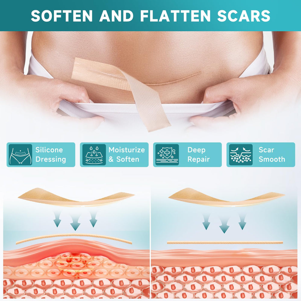 Pumkot silicone scar sheets roll unrolling to show length for daily wear