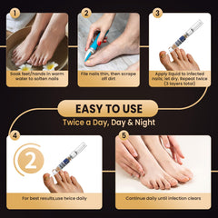 PUPCA Toenail Fungus Treatment Pen sleek design for easy maintenance.