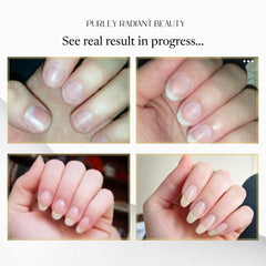 Purely Radiant Nail Growth Oil on nails for stronger, less brittle nails