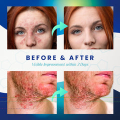 PureSkin-product-packaging-front image builds trust for sensitive-skin users.