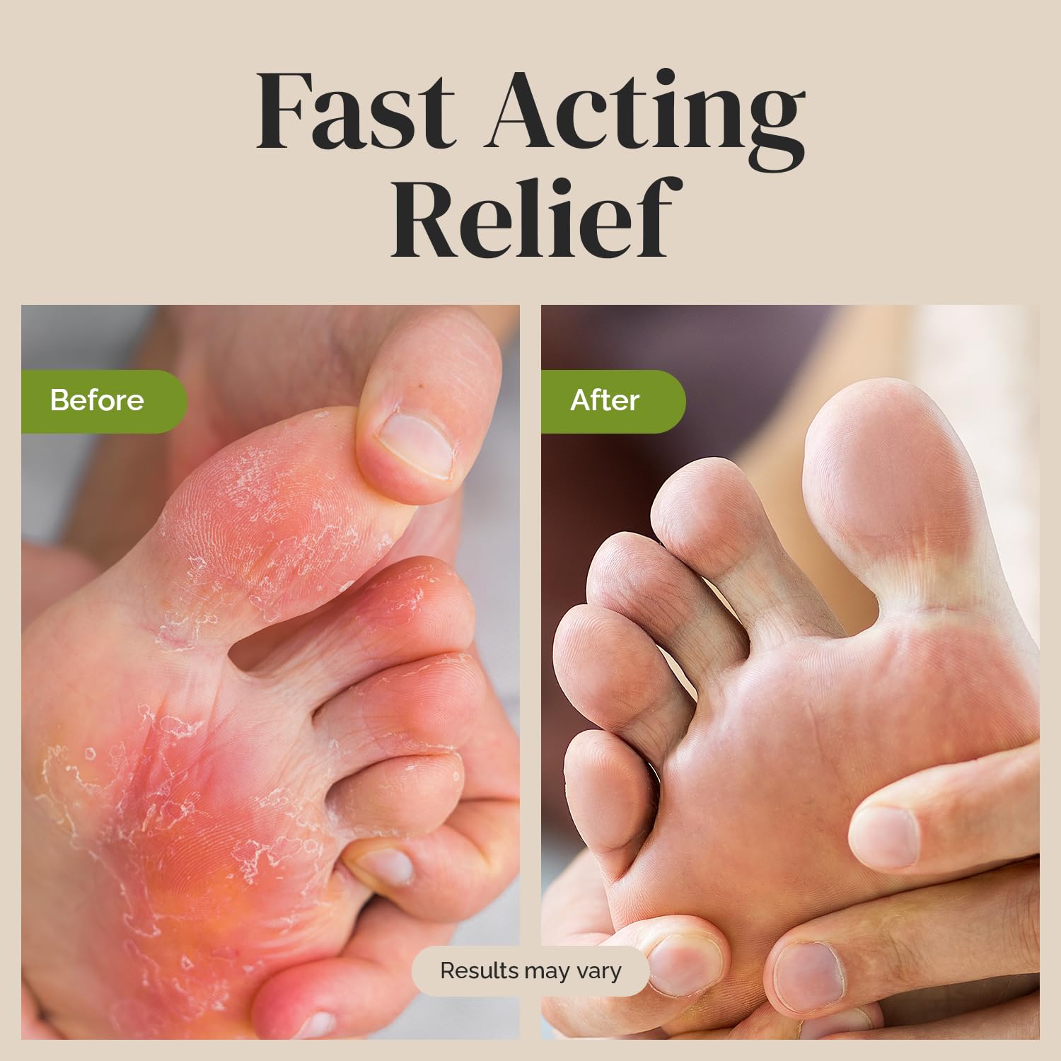 Puriya antifungal cream texture swirl shows smooth, moisturizing ointment for dry skin.
