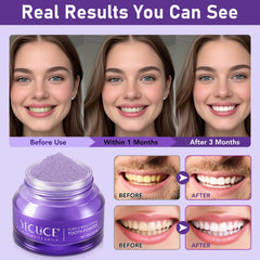 Toothpaste on toothbrush showcasing enamel-safe whitening