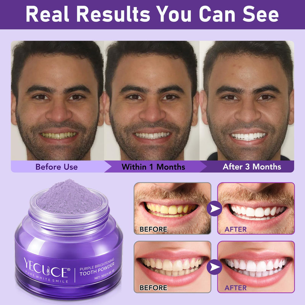 Bright, natural-looking smile after using purple whitening powder