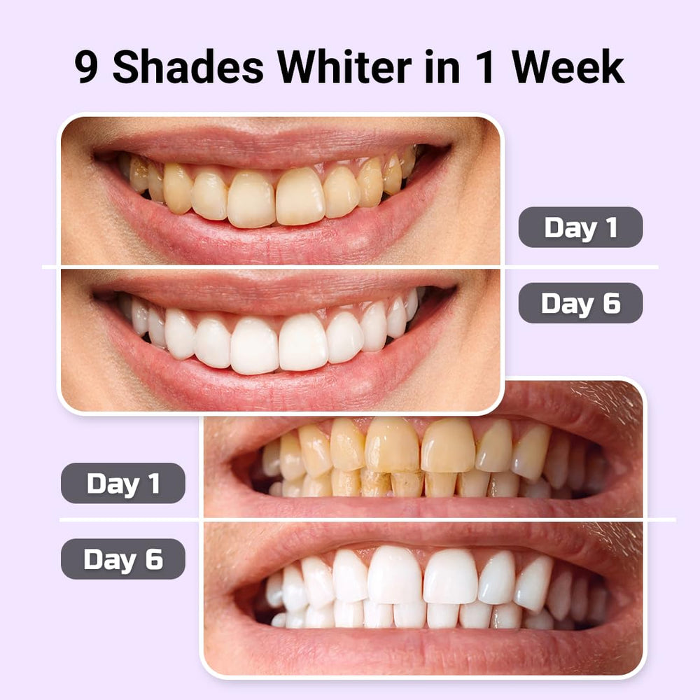 Enamel-safe design of the whitening kit