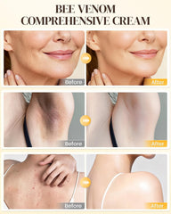 QISARONIX Bee Venom Cream hand applying to face for daily care