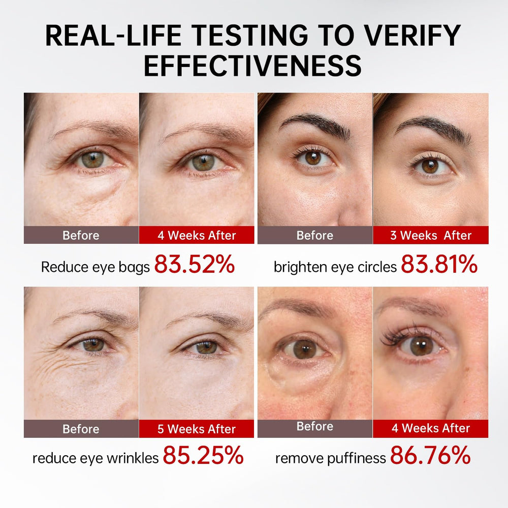 QQE dark circles eye cream with microencapsulated retinal for gentle care
