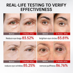 QQE dark circles eye cream with microencapsulated retinal for gentle care