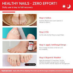 QQE Nail Fungus Treatment drops on nail demonstrate easy at-home care.