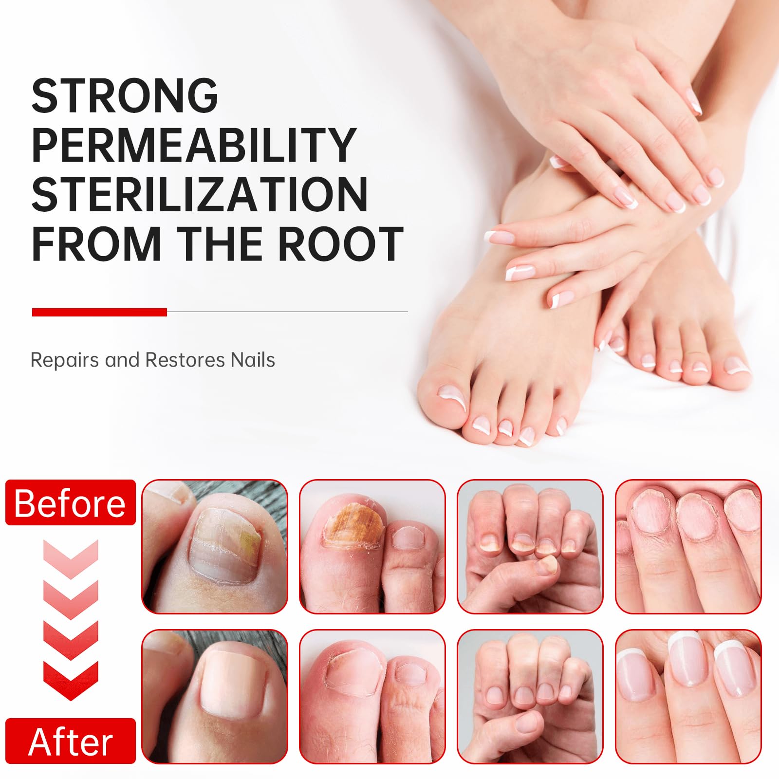 QQE Nail Fungus Treatment blends Aloe Vera and Tea Tree for soothing nail care.