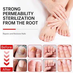QQE Nail Fungus Treatment blends Aloe Vera and Tea Tree for soothing nail care.