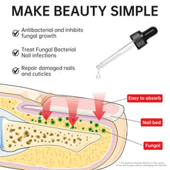 QQE Nail Fungus Treatment packaging details bottle size and usage directions.