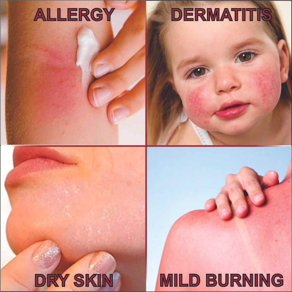 QUATRIDERM NF with Aloe Vera detail emphasizes soothing, calming irritated skin.