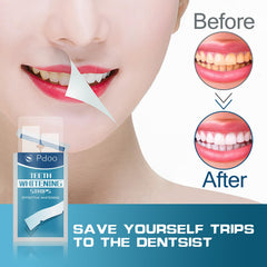 Quick Teeth Whitening Results in 30 Minutes