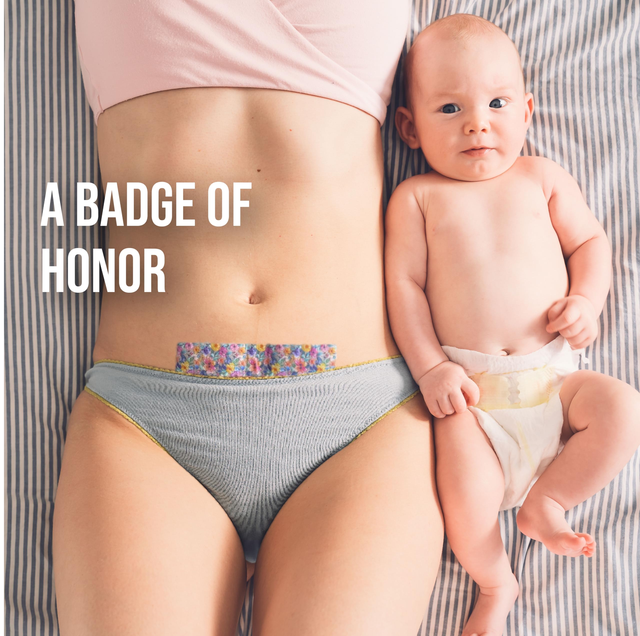 Quitch silicone scar sheets breathable skin coverage in daily wear