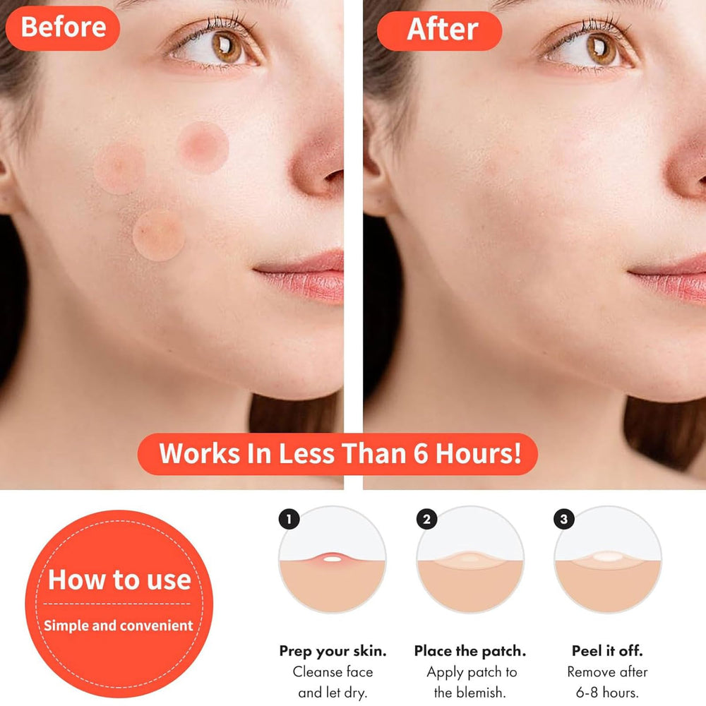 QUYVANDOR Centella and Tea Tree soothe redness around blemishes, calming the skin.