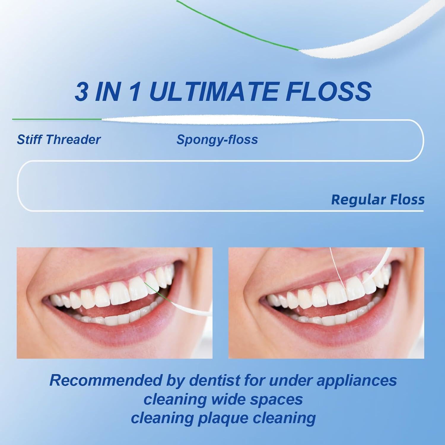 Floss threading under braces wires for easy cleaning
