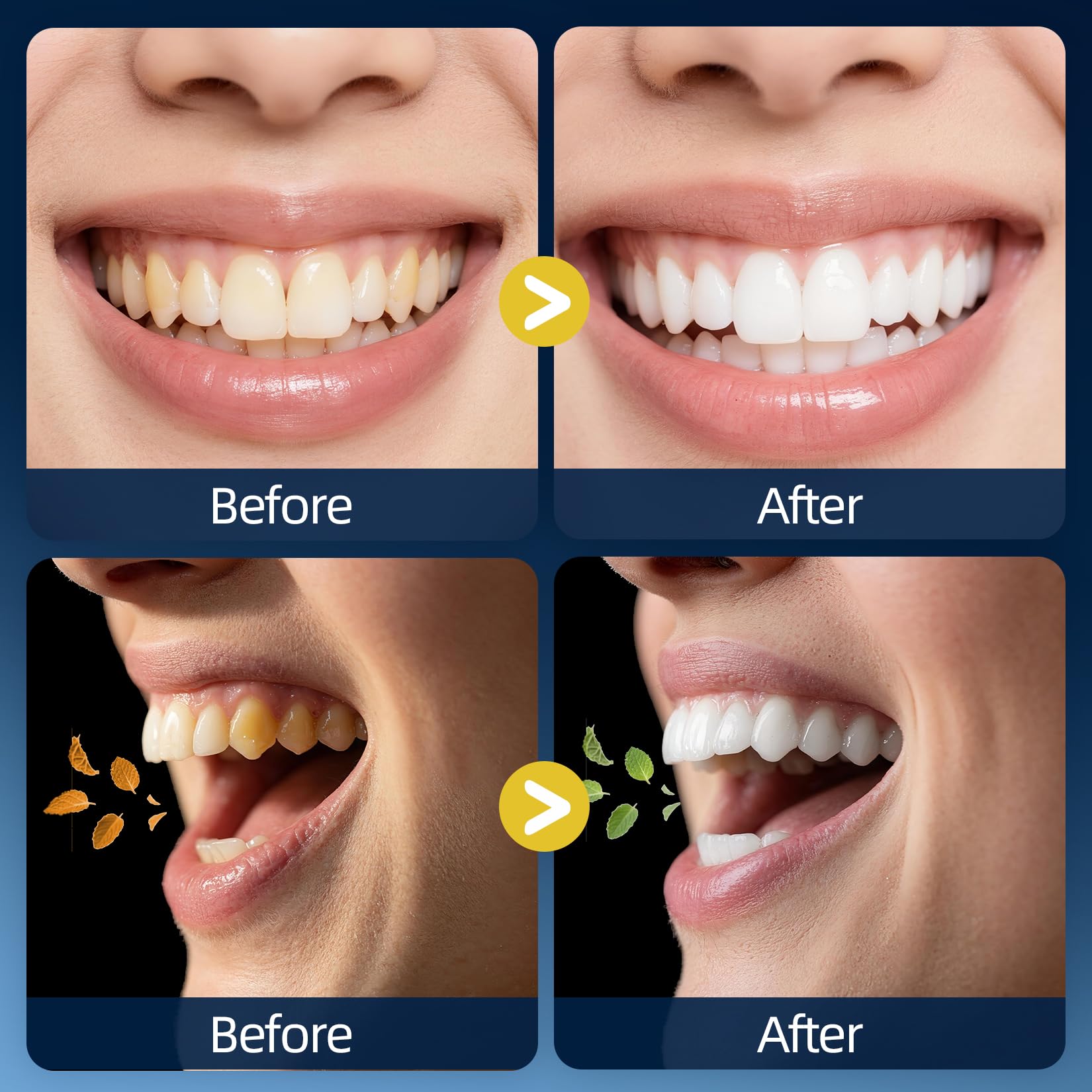 Fluoride-free mouthwash for sensitive gums