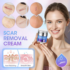 Reatoy scar cream application on scar demonstrates gentle coverage