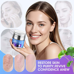 Reatoy silicone scar cream in use at mirror-ready routine