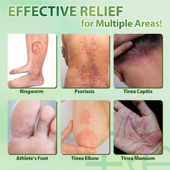 Recuren Plus Compact 20g tube ideal for travel.