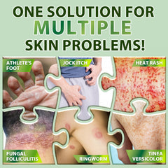 Recuren Plus-cream-application-hand demonstrates easy-to-apply daily use.
