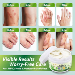 Recuren Plus-skin-barrier-protection emphasizes non-greasy hydration and protective feel.
