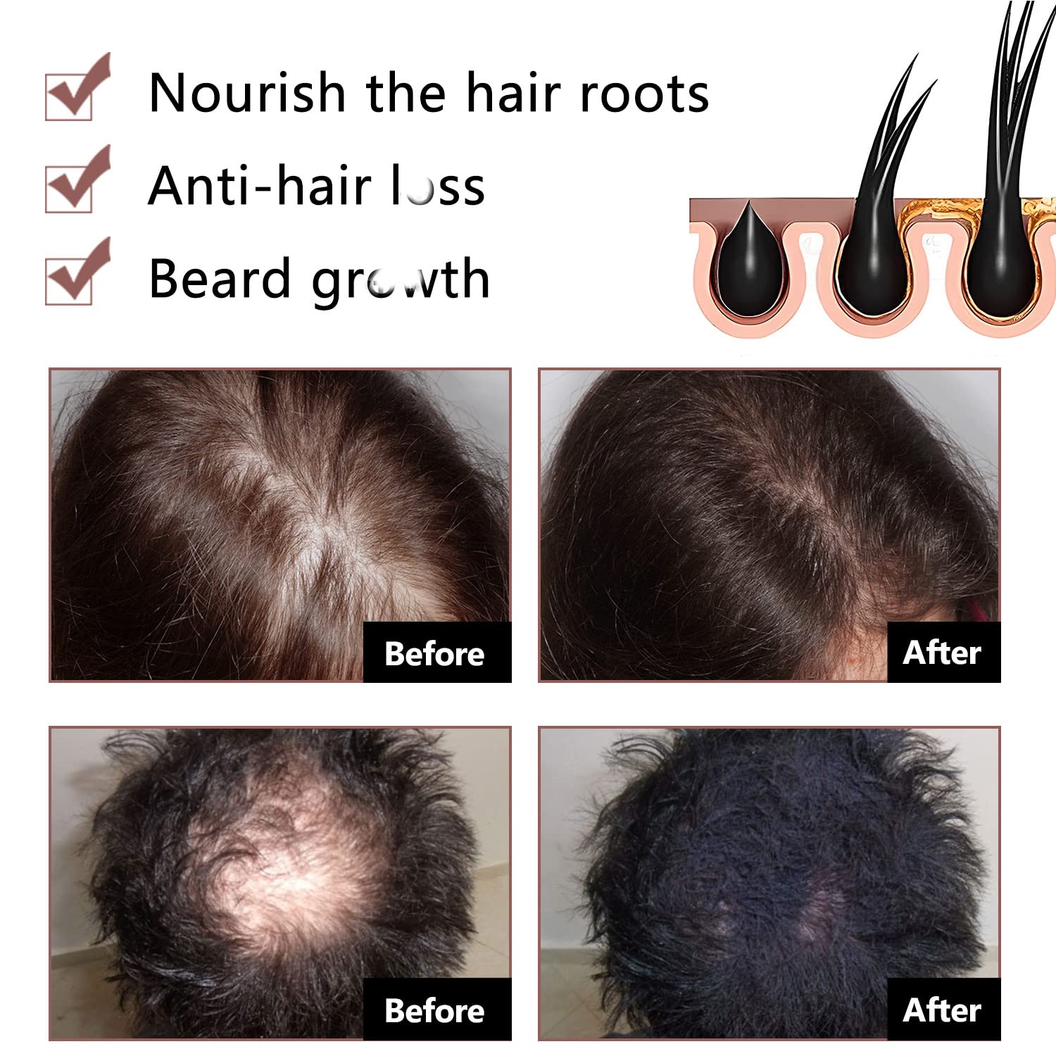 Rednow Shou Wu extract bar emphasizing herbal formula for scalp care