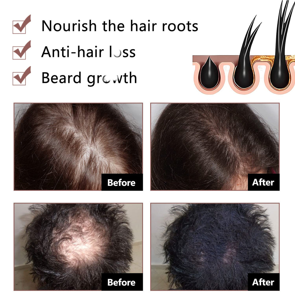 Rednow Shou Wu extract bar emphasizing herbal formula for scalp care