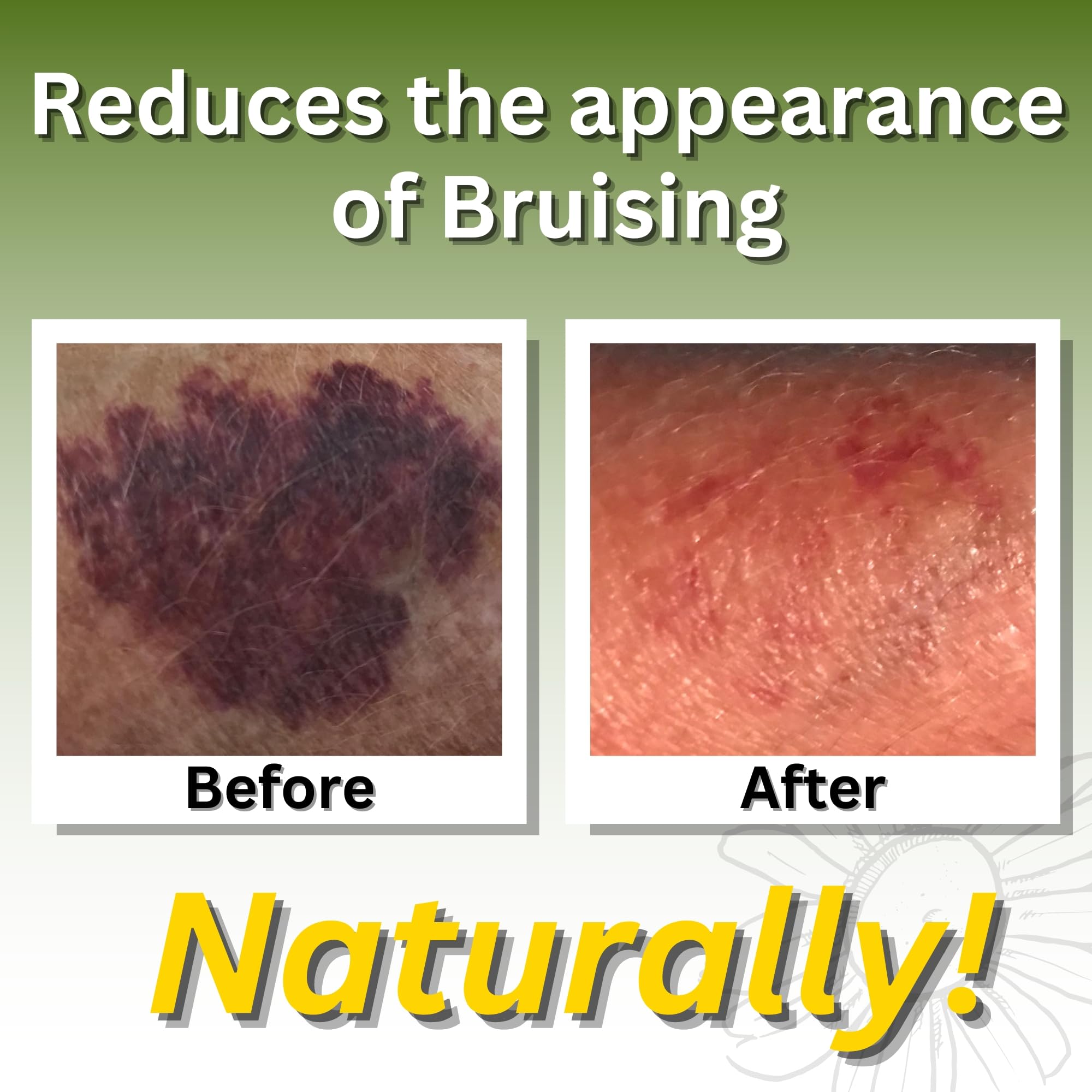 Close-up of Relief Arnica Cream for sore muscles