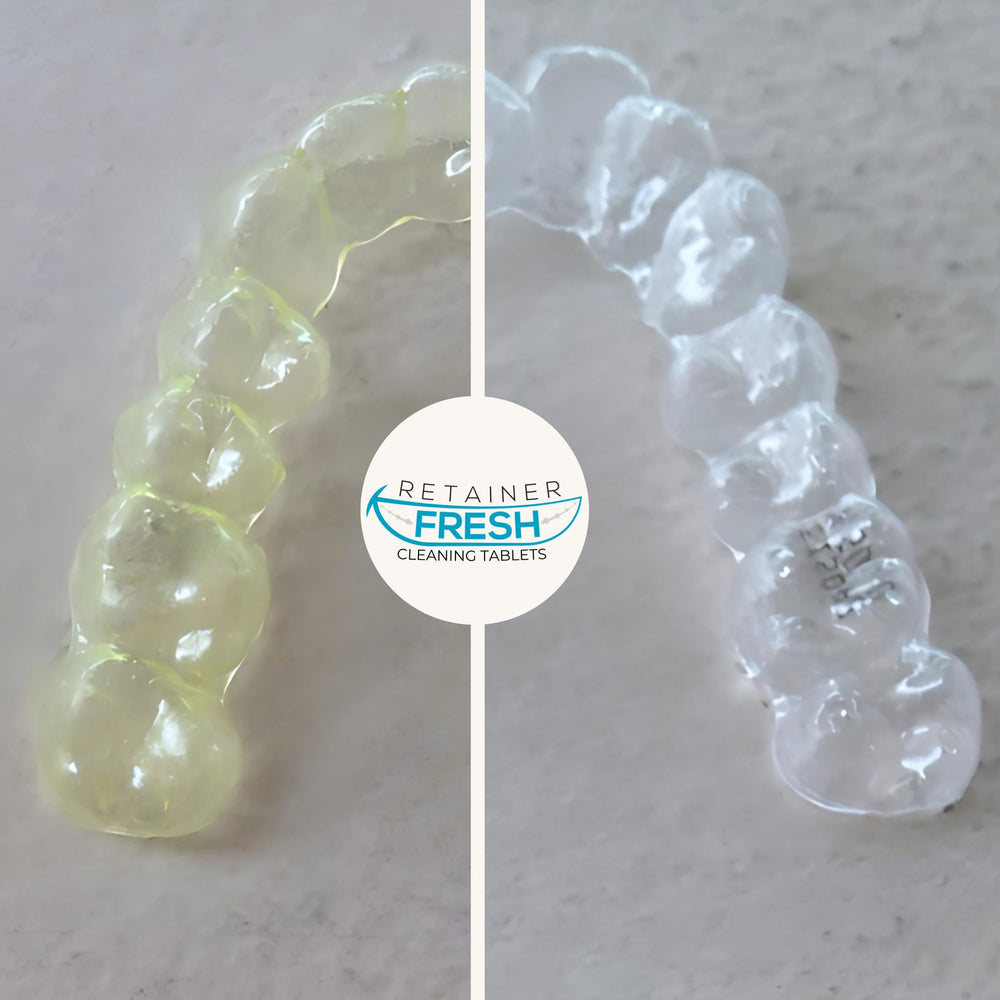 Getting started with aligners eBook cover