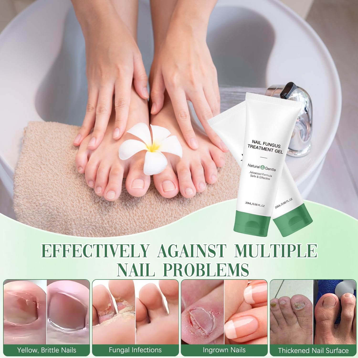 Retigazo Nail Repair Gel damaged-nails-before shows potential restoration look