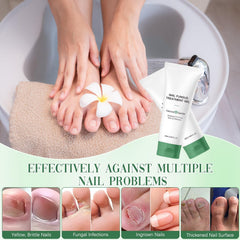 Retigazo Nail Repair Gel damaged-nails-before shows potential restoration look