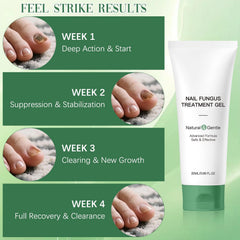 Retigazo Nail Repair Gel nails-after suggests smoother, healthier-looking nails with regular use