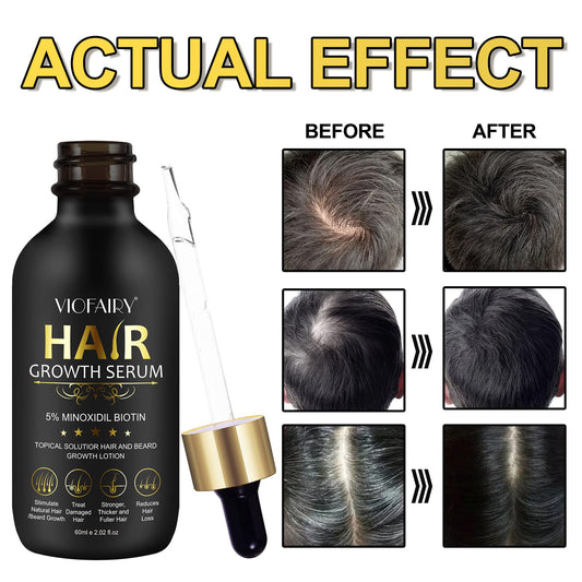 RHBESTOK Biotin serum bottle promotes healthier follicles and hair resilience.