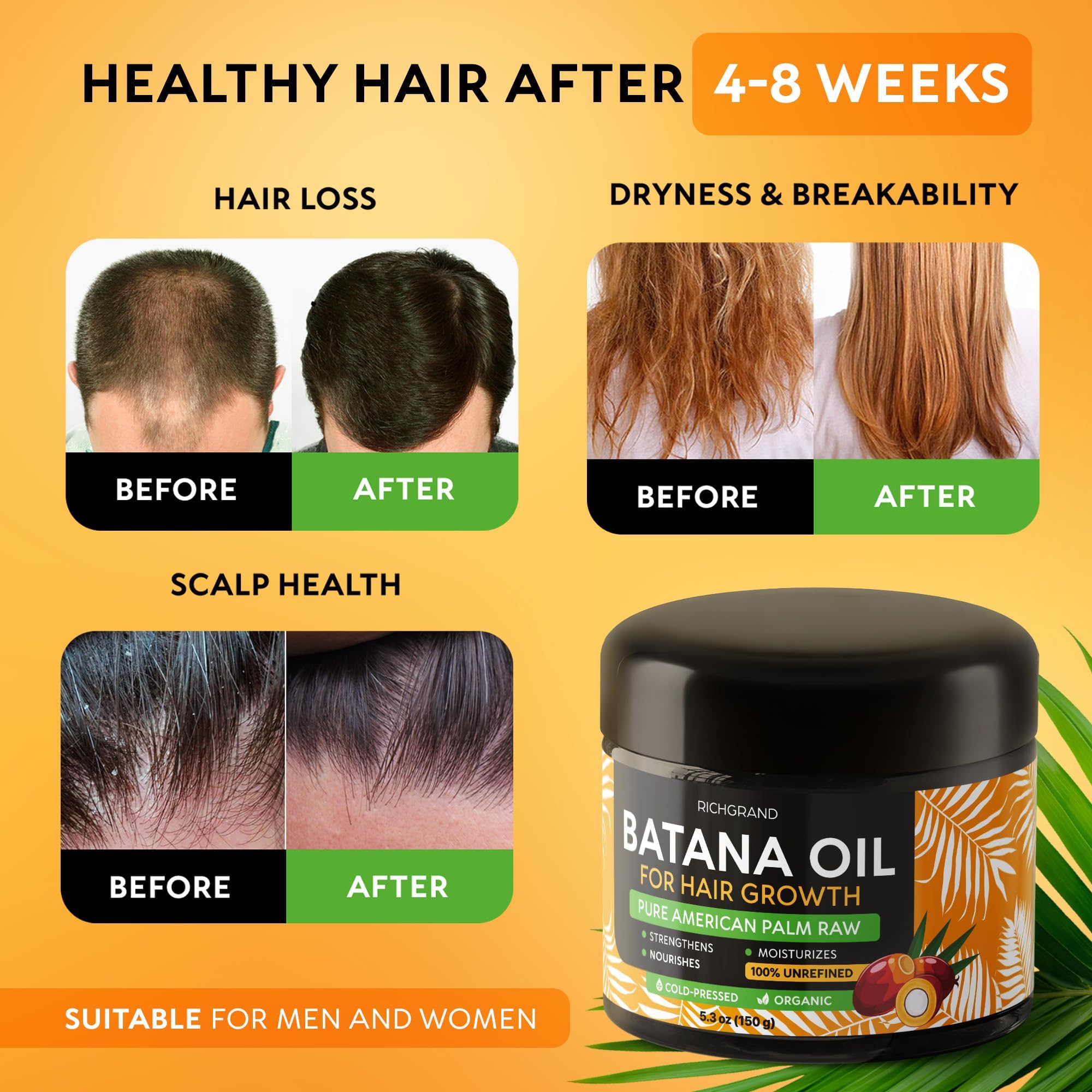 RICHGRAND Batana Oil hair application adds hydration to dry curls.