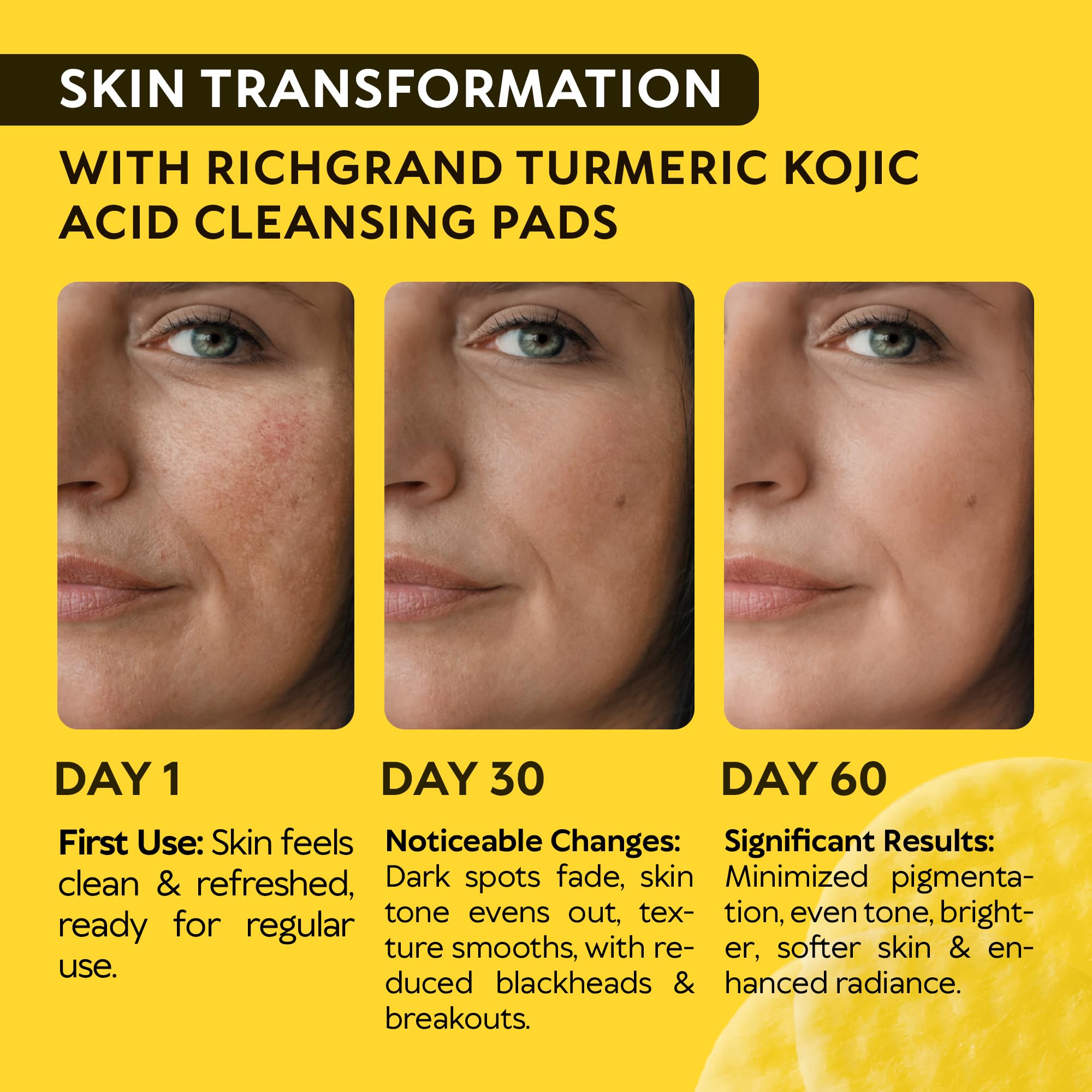 Close-up of the exfoliating texture on RichGrand Pad