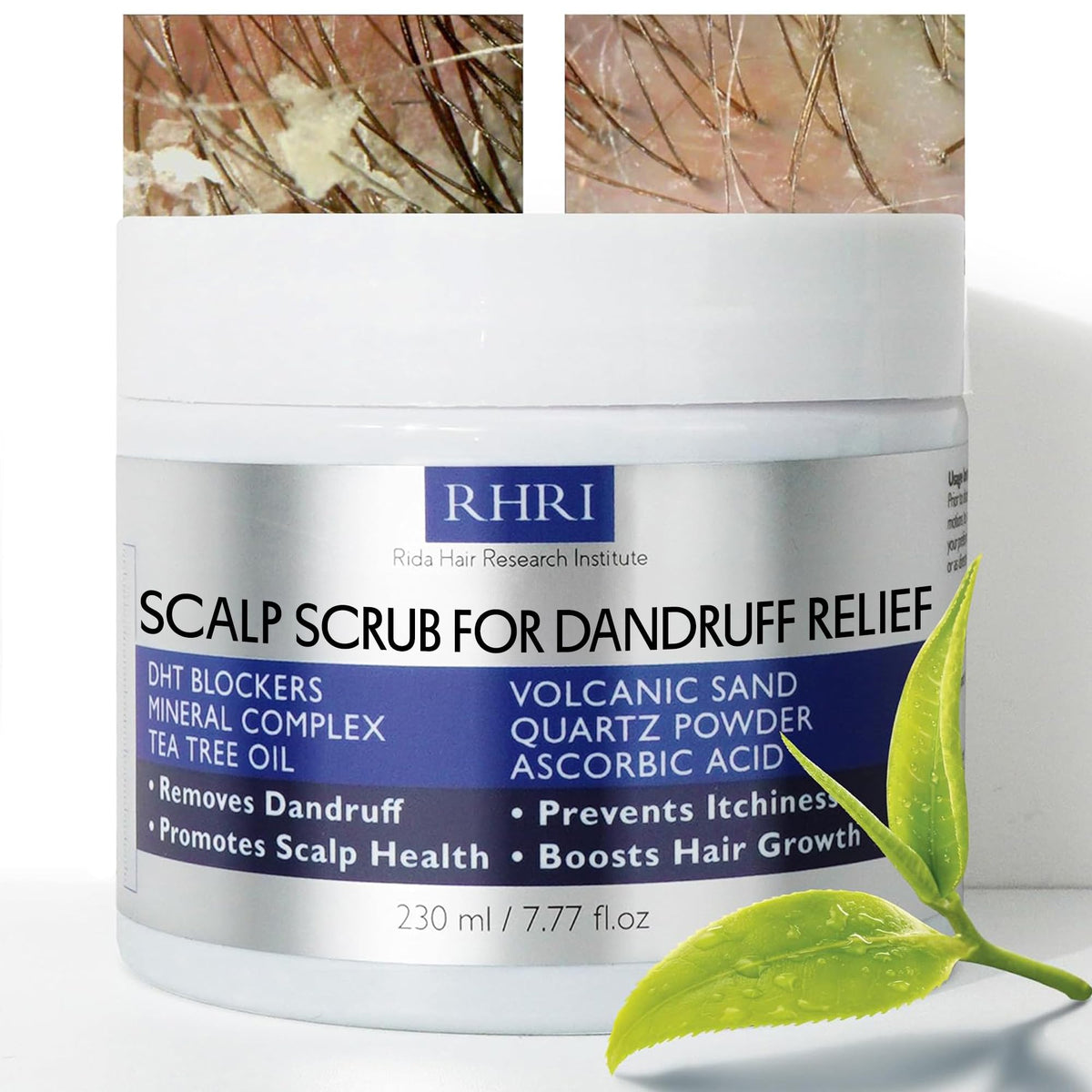 Rida Hair Anti Dandruff Scrub bottle on display highlighting scalp care benefits.
