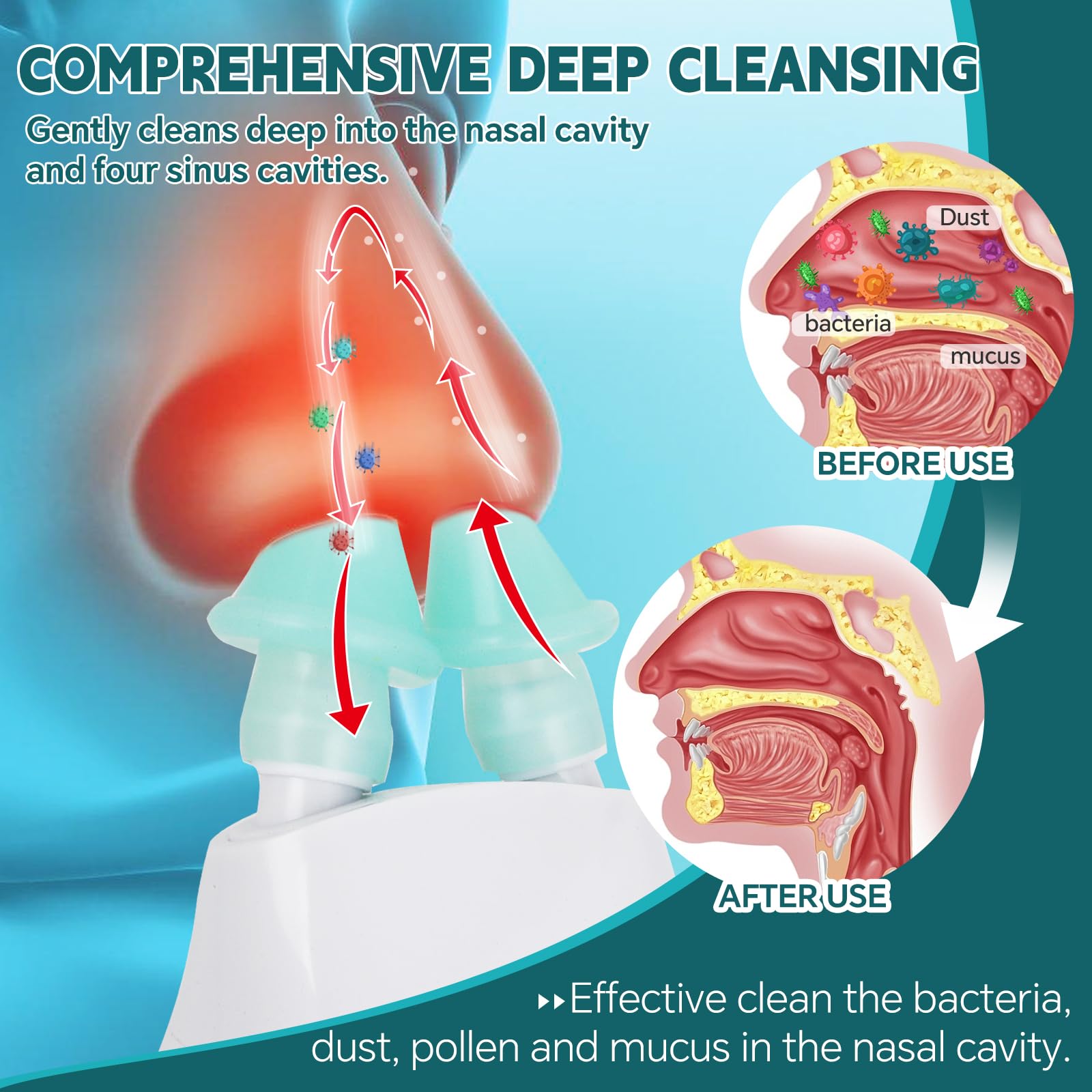 Ronfnea nasal irrigation tips set image featuring soft silicone tips for comfort