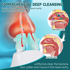 Ronfnea nasal irrigation tips set image featuring soft silicone tips for comfort