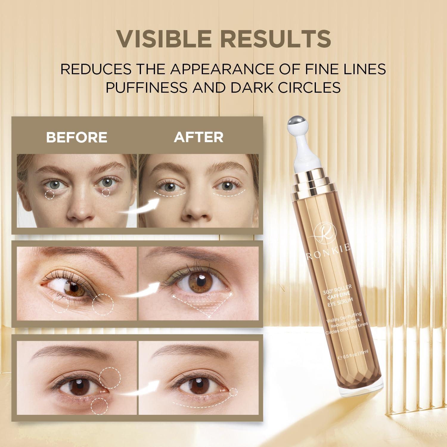 RONKIE eye cream helps smooth fine lines around the eyes.