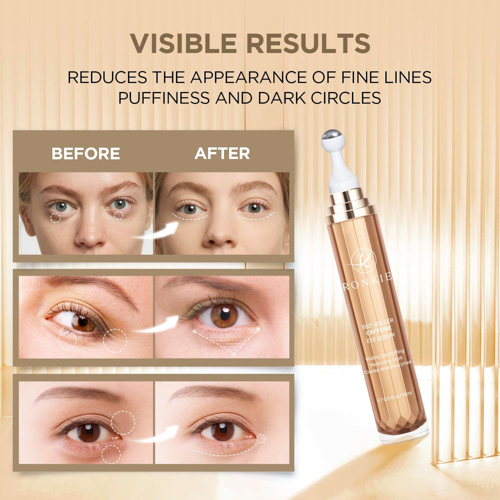 RONKIE eye cream helps smooth fine lines around the eyes.
