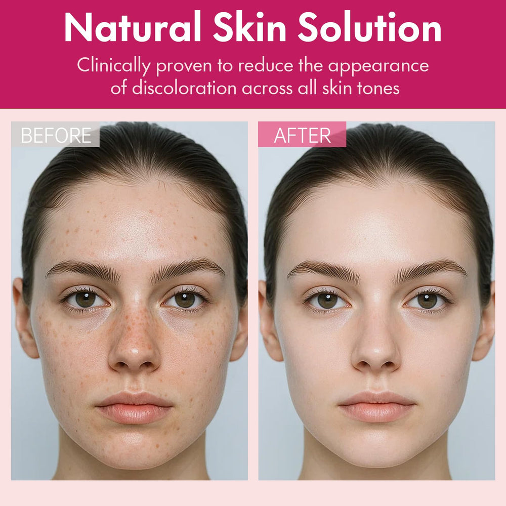 Roseblem eye-area discoloration targeting visual for even tone around delicate areas