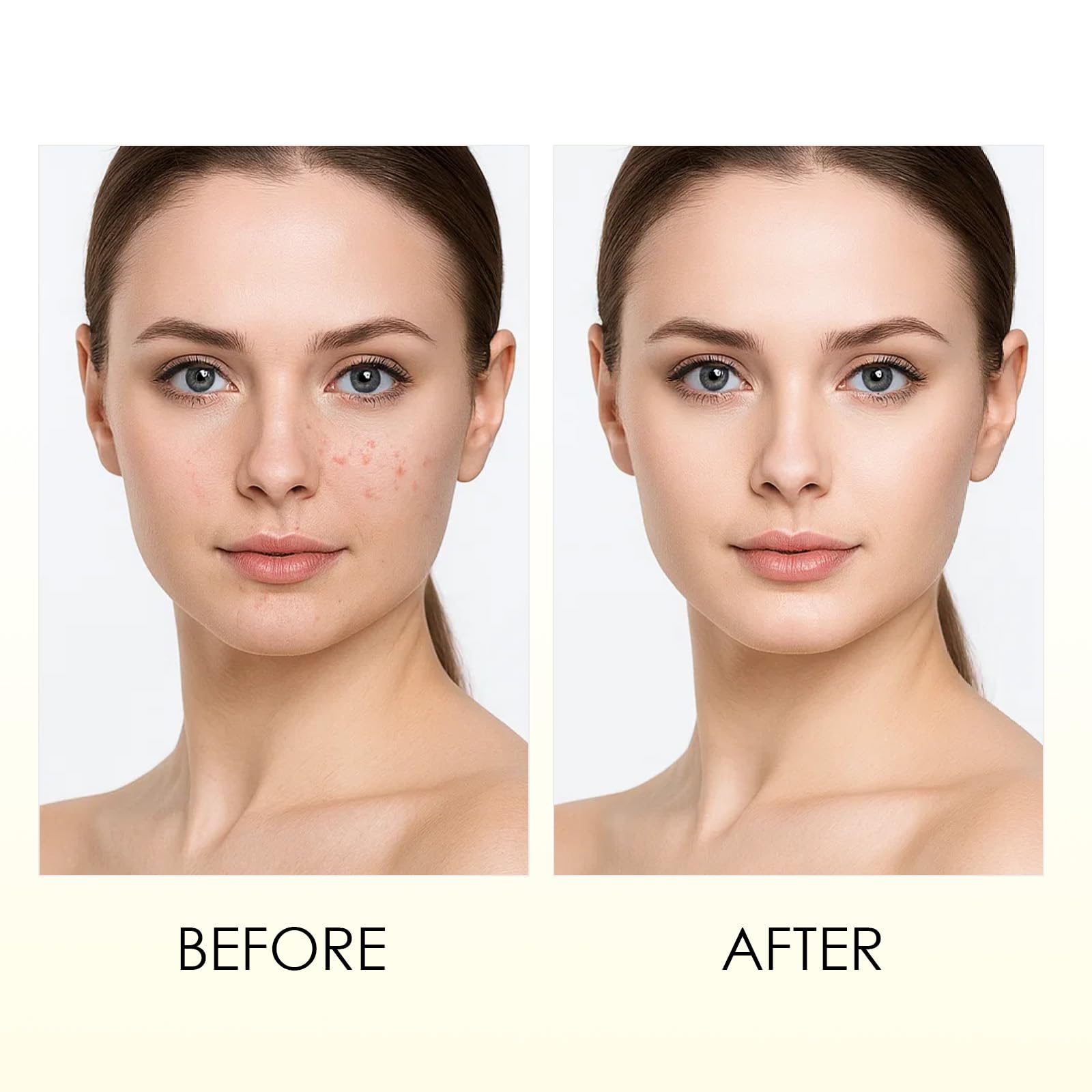 Roseblem Relief Cream vegan formula free of fragrance for sensitive skin