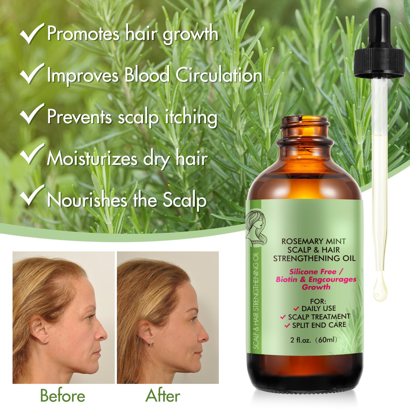 Rosemary oil nourishing the scalp for hair growth