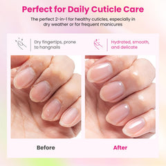 Rosiour Cuticle Remover Cream softens cuticles in seconds for gentle care.