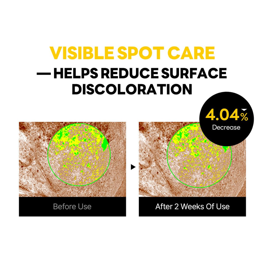 ROUND LAB Vita Niacinamide Dark Spot Cream exfoliation detail with LHA and PHA